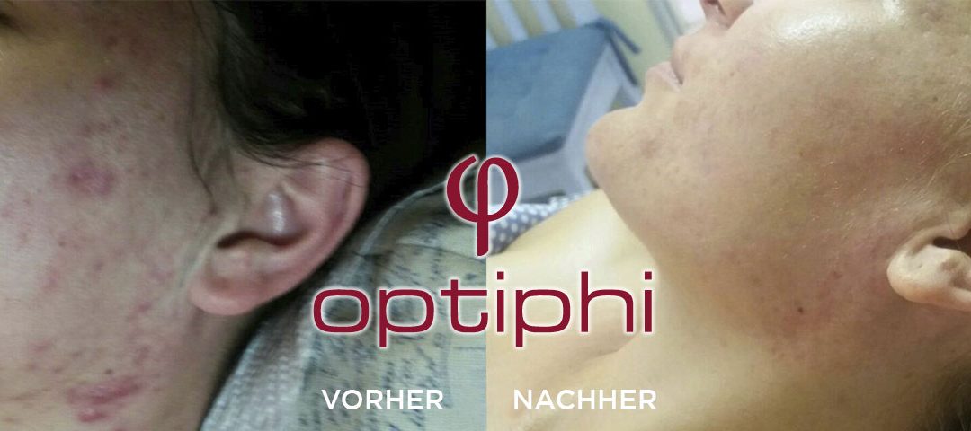 Das Pubertier