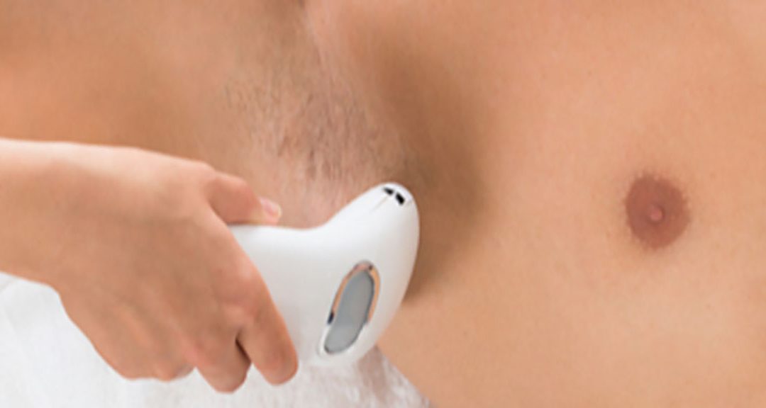 HAARE ÜBERALL DA, WO WIR SIE NICHT BRAUCHEN Kapitel 5